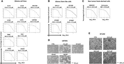 Anticancer effects of ABTL0812, a clinical stage drug inducer of autophagy-mediated cancer cell death, in glioblastoma models